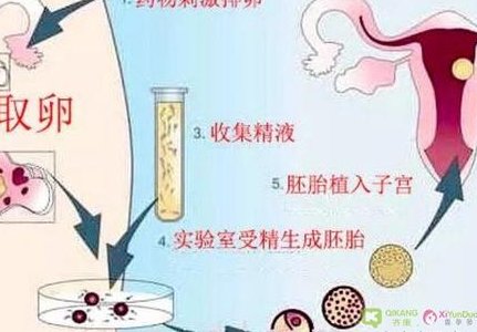 2026年梅毒在希腊雅典做三代试管需要花费多少钱？费用明细详解