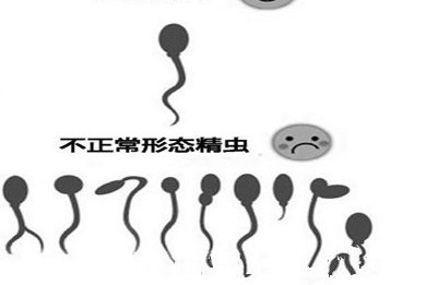 做b超检查需要多少钱？