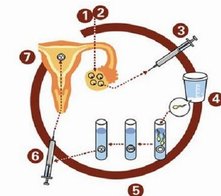 贵阳试管婴儿生孩子，2026年贵阳生孩子试管医院名单推荐
