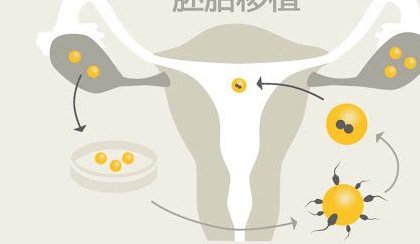 泰国三代试管婴儿大概费用，提前了解更省心